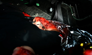 ćwiczenia z zakresu medycyny walki